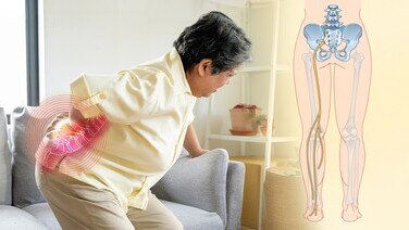 长者腰背脚痛莫轻视! 认识坐骨神经痛